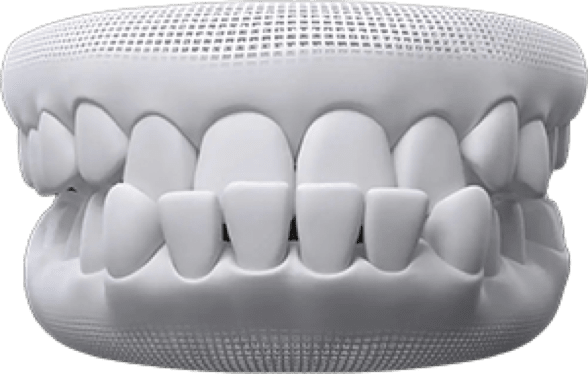 Underbite invisalign before after