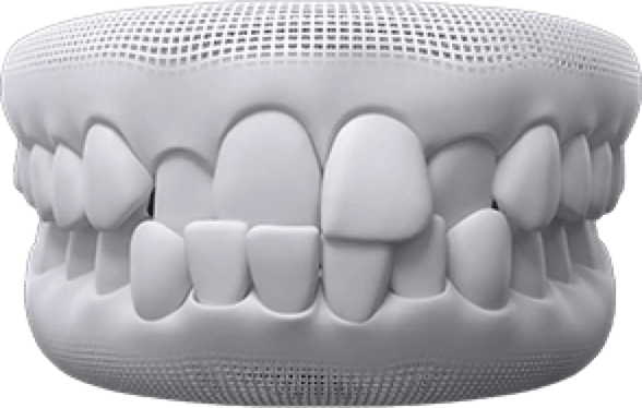Gaps between teeth invisalign before after