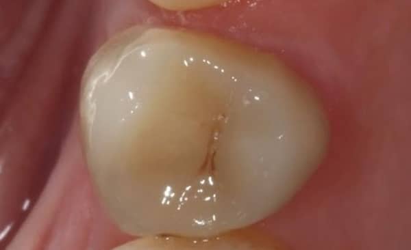 After - Taylored Dental Care