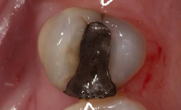 Before - Taylored Dental Care