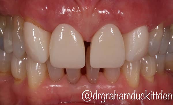 After - Taylored Dental Care