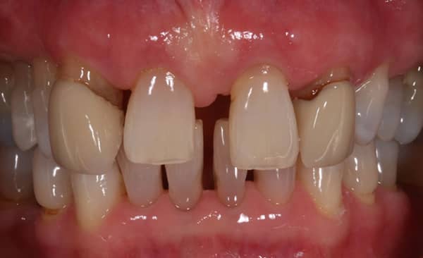 Before - Taylored Dental Care