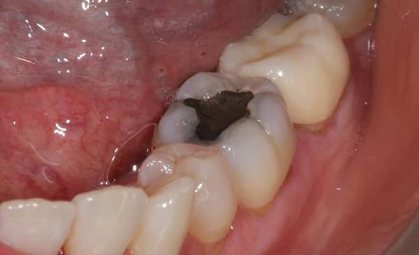 Before - Taylored Dental Care