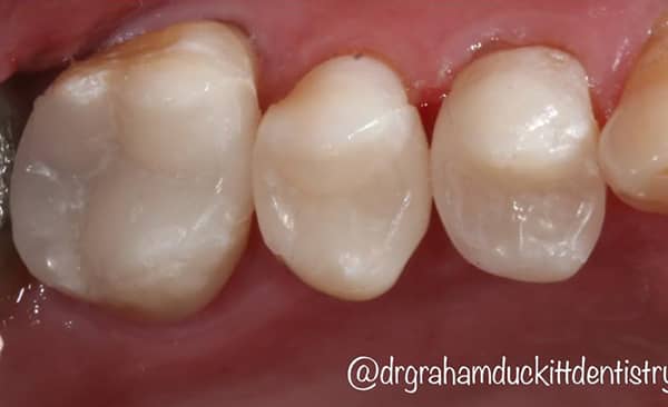 After - Taylored Dental Care