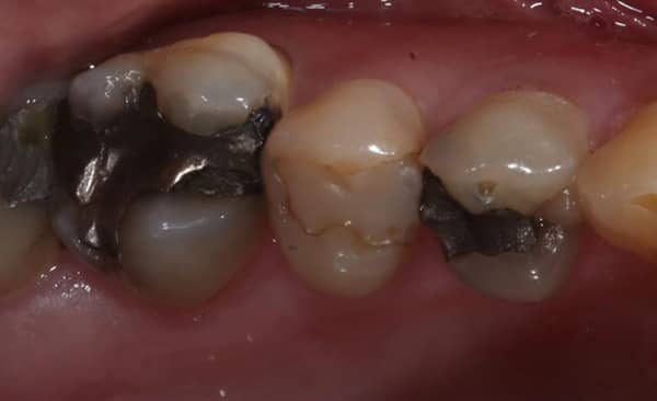 Before - Taylored Dental Care
