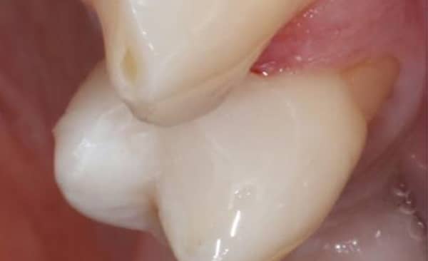 After - Taylored Dental Care