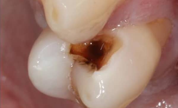 Before - Taylored Dental Care