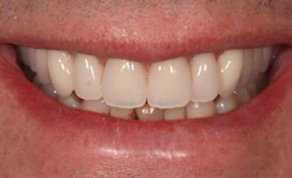 After - Taylored Dental Care