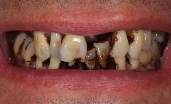 Before - Taylored Dental Care