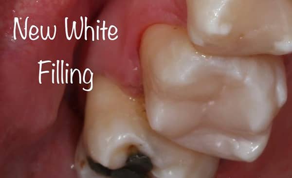 After - Taylored Dental Care