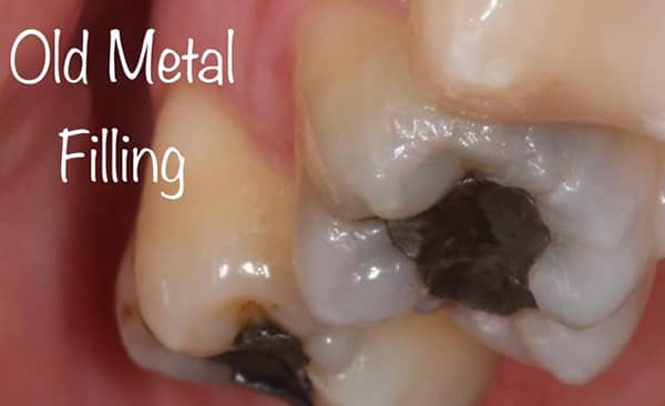 Before - Taylored Dental Care