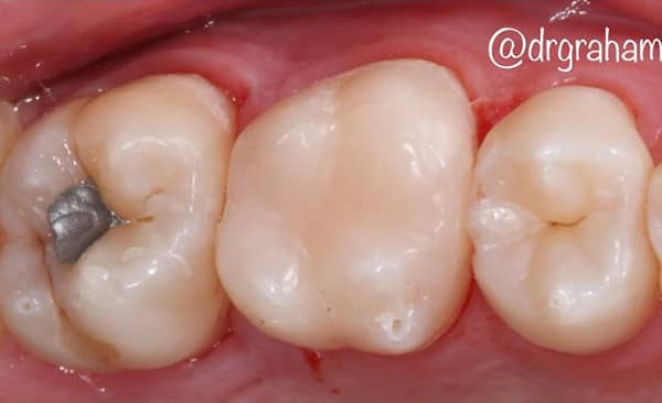 After - Taylored Dental Care