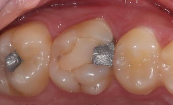 Before - Taylored Dental Care