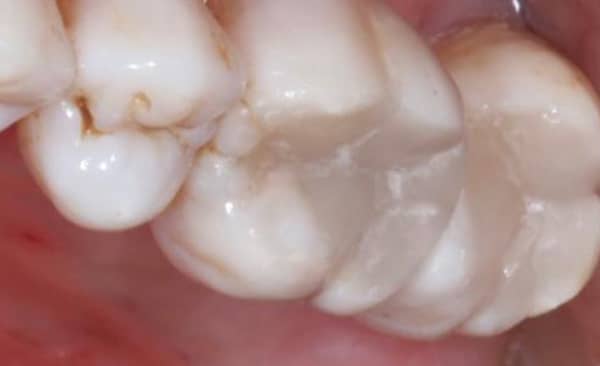 After - Taylored Dental Care