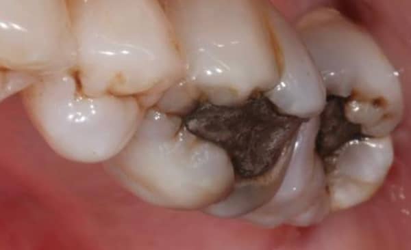 Before - Taylored Dental Care