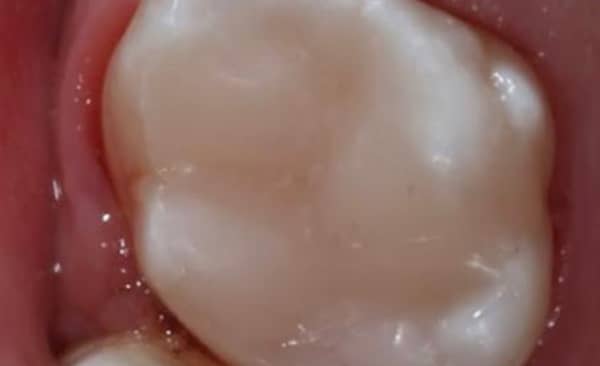 After - Taylored Dental Care