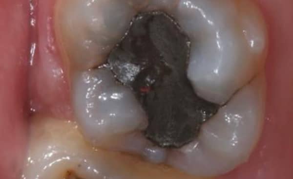 Before - Taylored Dental Care