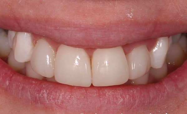 After - Taylored Dental Care