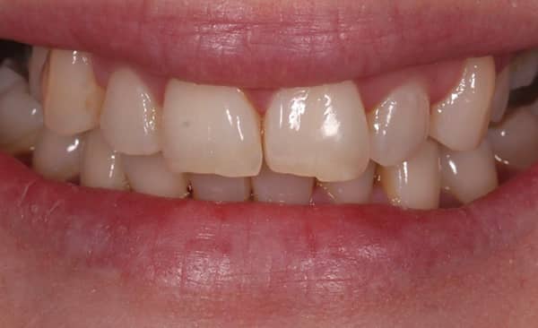 Before - Taylored Dental Care