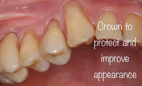 After - Taylored Dental Care