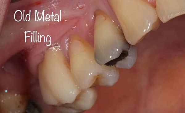 Before - Taylored Dental Care