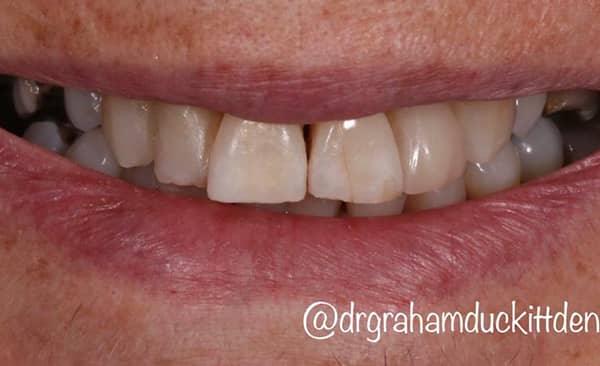After - Taylored Dental Care