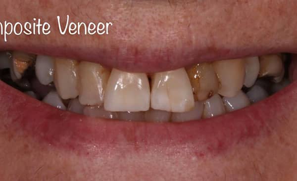 Before - Taylored Dental Care