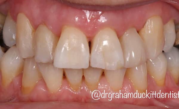 After - Taylored Dental Care