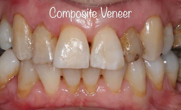 Before - Taylored Dental Care