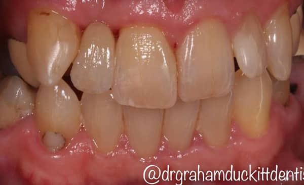 After - Taylored Dental Care