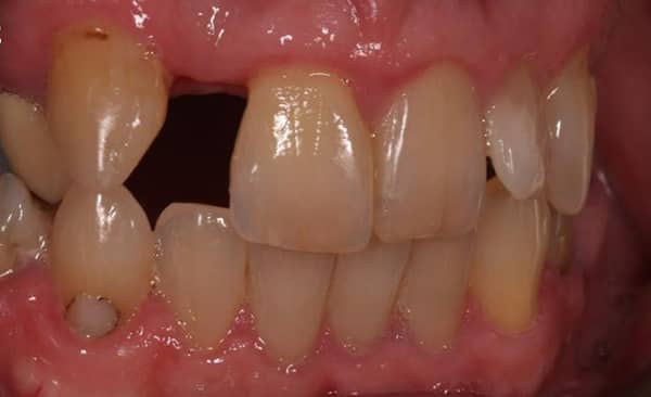 Before - Taylored Dental Care