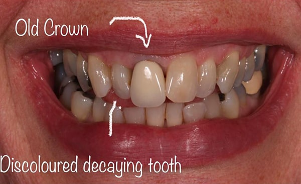 Before - Taylored Dental Care