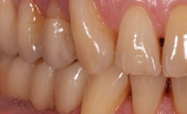 Before - Taylored Dental Care