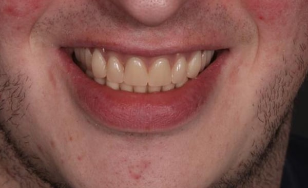 After - Taylored Dental Care