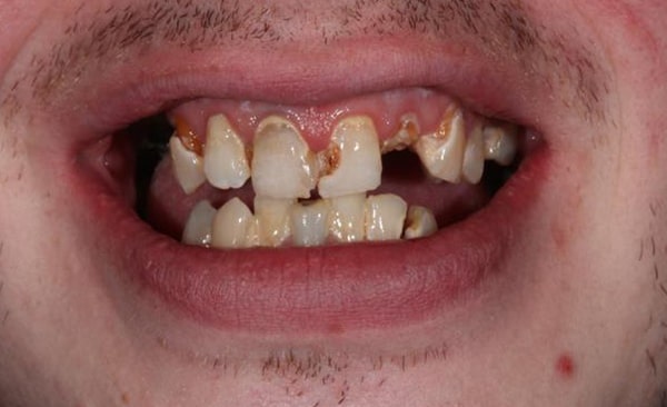 Before - Taylored Dental Care