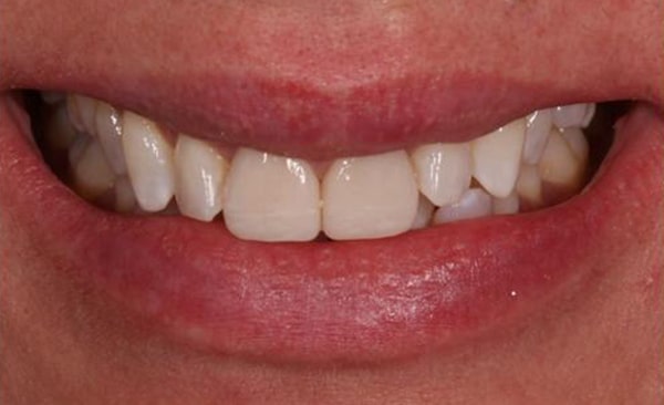 After - Taylored Dental Care