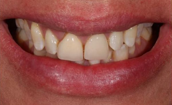 Before - Taylored Dental Care