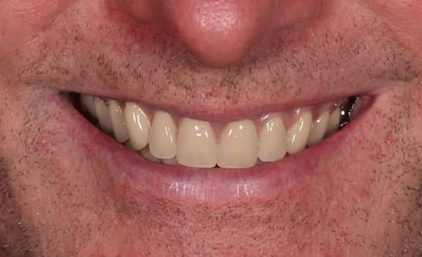 After - Taylored Dental Care