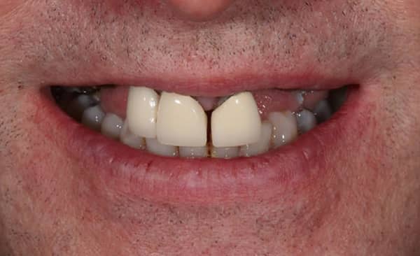Before - Taylored Dental Care