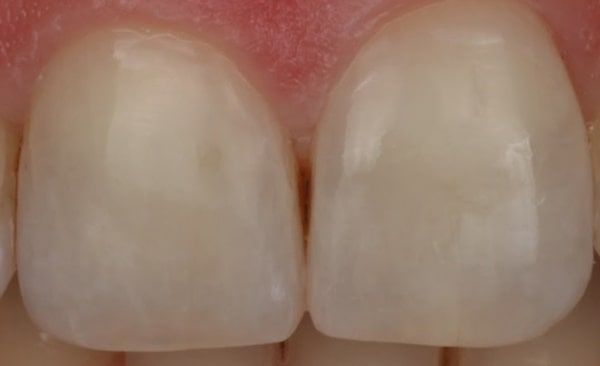 After - Taylored Dental Care