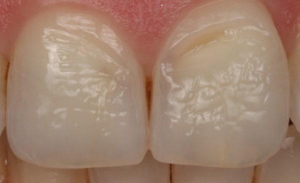 Before - Taylored Dental Care