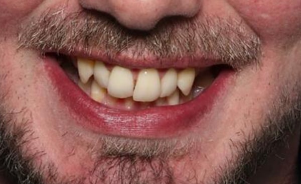 Before - Taylored Dental Care