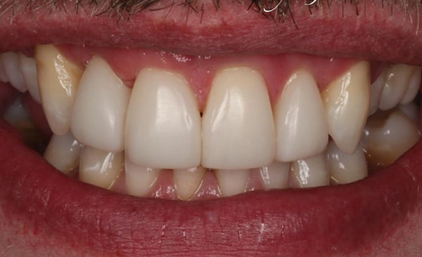 After - Taylored Dental Care