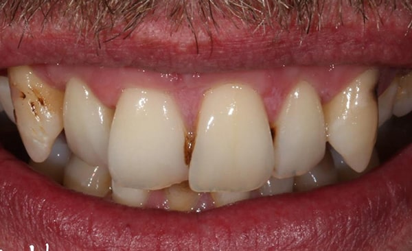 Before - Taylored Dental Care