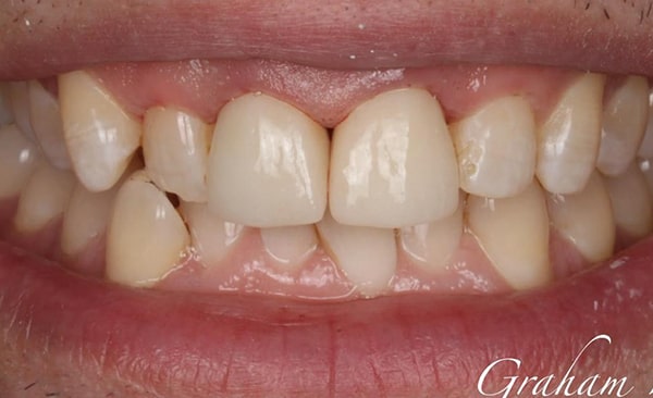 After - Taylored Dental Care