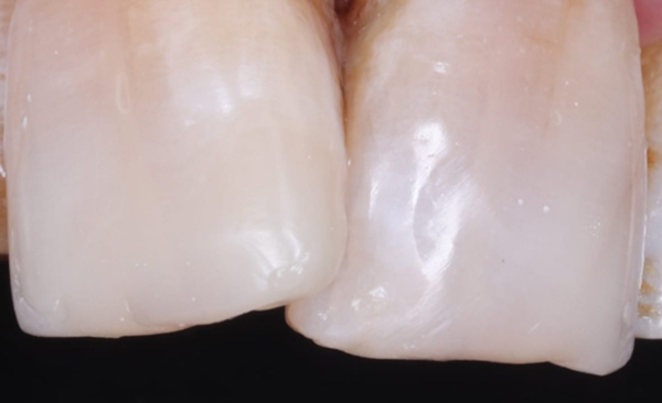 After - Taylored Dental Care