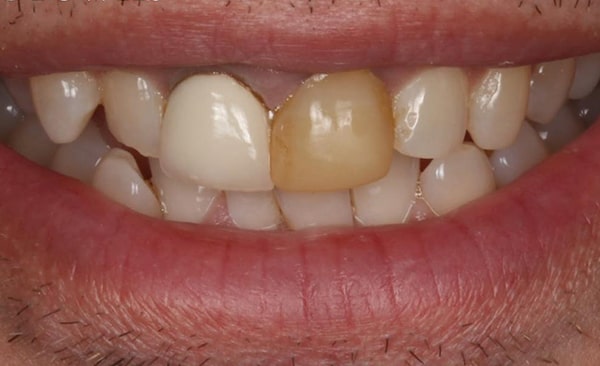 Before - Taylored Dental Care