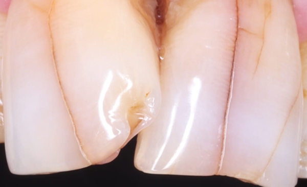 Before - Taylored Dental Care