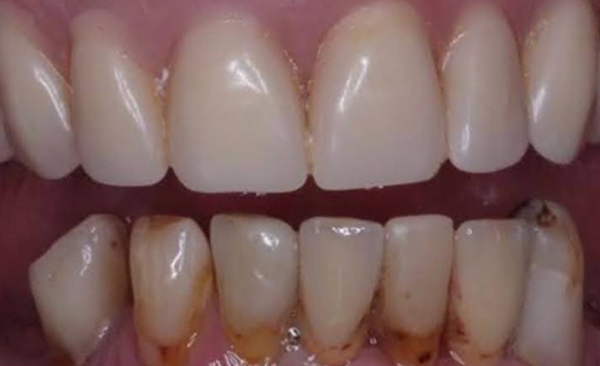 After - Taylored Dental Care