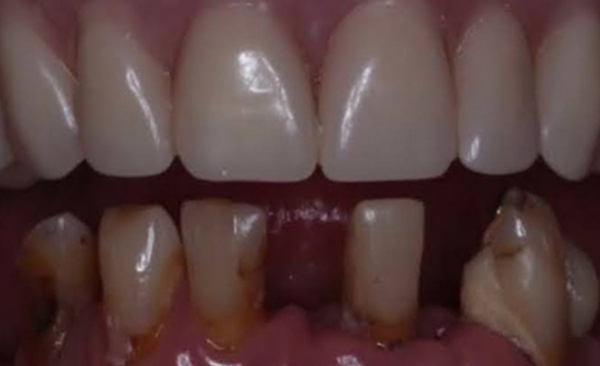 Before - Taylored Dental Care